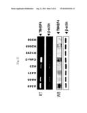 METHOD FOR DECREASING RADIORESISTANCE AND GROWTH, METASTASIS AND     INFILTRATION OF CANCER CELLS THROUGH REGULATING EXPRESSION OR ACTIVITY OF     TM4SF4 IN NON-SMALL CELL LUNG CANCER diagram and image