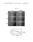 METHOD FOR DECREASING RADIORESISTANCE AND GROWTH, METASTASIS AND     INFILTRATION OF CANCER CELLS THROUGH REGULATING EXPRESSION OR ACTIVITY OF     TM4SF4 IN NON-SMALL CELL LUNG CANCER diagram and image