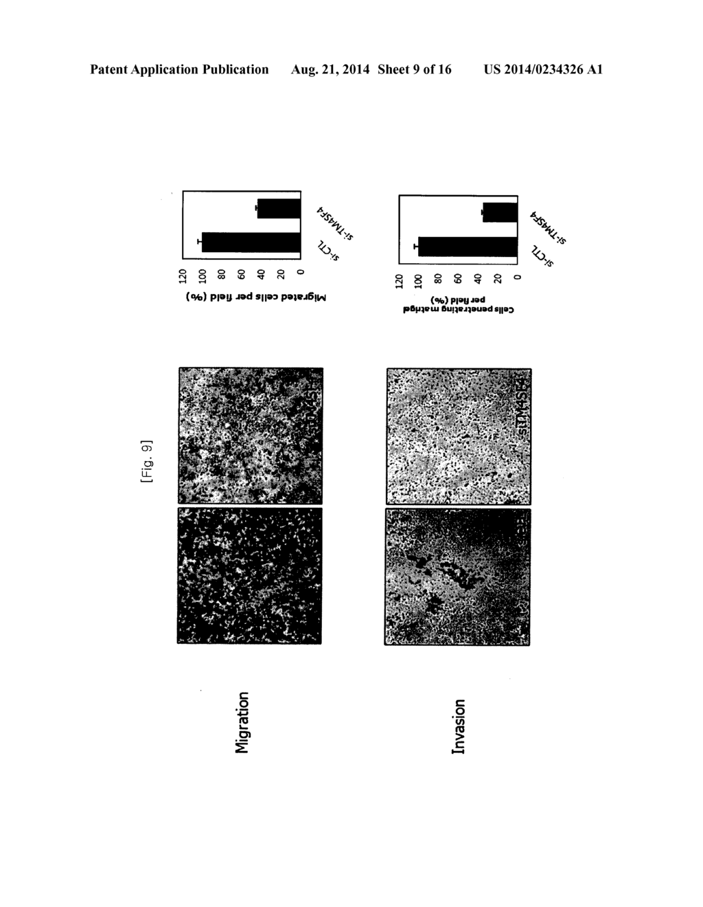 METHOD FOR DECREASING RADIORESISTANCE AND GROWTH, METASTASIS AND     INFILTRATION OF CANCER CELLS THROUGH REGULATING EXPRESSION OR ACTIVITY OF     TM4SF4 IN NON-SMALL CELL LUNG CANCER - diagram, schematic, and image 10