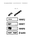 METHOD FOR DECREASING RADIORESISTANCE AND GROWTH, METASTASIS AND     INFILTRATION OF CANCER CELLS THROUGH REGULATING EXPRESSION OR ACTIVITY OF     TM4SF4 IN NON-SMALL CELL LUNG CANCER diagram and image