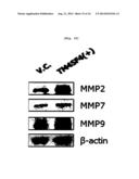 METHOD FOR DECREASING RADIORESISTANCE AND GROWTH, METASTASIS AND     INFILTRATION OF CANCER CELLS THROUGH REGULATING EXPRESSION OR ACTIVITY OF     TM4SF4 IN NON-SMALL CELL LUNG CANCER diagram and image