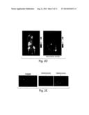 METHODS AND PRODUCTS FOR IN VIVO ENZYME PROFILING diagram and image