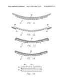 Flexible Circuit Electrode Array and a Method for Backside Processing of a     Flexible Circuit Electrode Device diagram and image