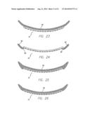 Flexible Circuit Electrode Array and a Method for Backside Processing of a     Flexible Circuit Electrode Device diagram and image