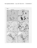 Tumor biomarkers for pancreatic marker diagram and image