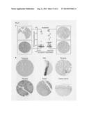 Tumor biomarkers for pancreatic marker diagram and image