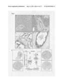 Tumor biomarkers for pancreatic marker diagram and image