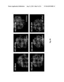 MICRORNA PATTERNS FOR THE DIAGNOSIS, PROGNOSIS AND TREATMENT OF MELANOMA diagram and image