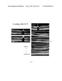 COMPOUNDS AND METHODS OF TREATING OCULAR DISORDERS diagram and image