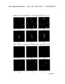 AGENTS AND METHODS FOR TREATING ISCHEMIC AND OTHER DISEASES diagram and image