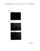 AGENTS AND METHODS FOR TREATING ISCHEMIC AND OTHER DISEASES diagram and image