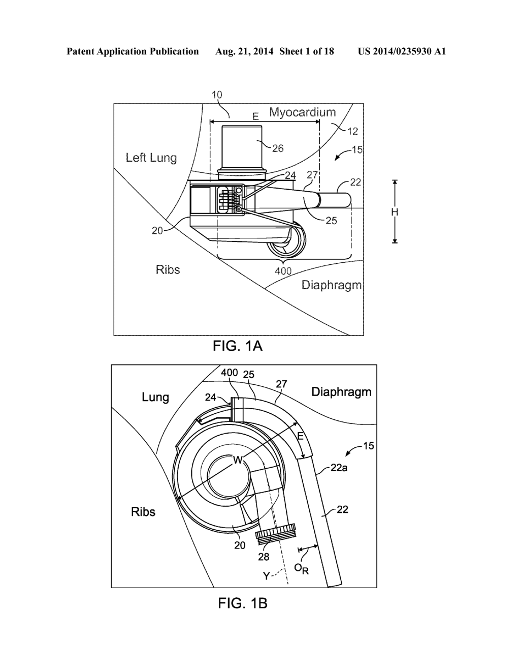 DRIVELINE CABLE ASSEMBLY - diagram, schematic, and image 02