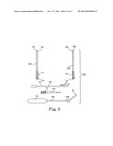 MINIMALLY INVASIVE LEVATOR AVULSION REPAIR diagram and image