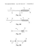 MINIMALLY INVASIVE LEVATOR AVULSION REPAIR diagram and image