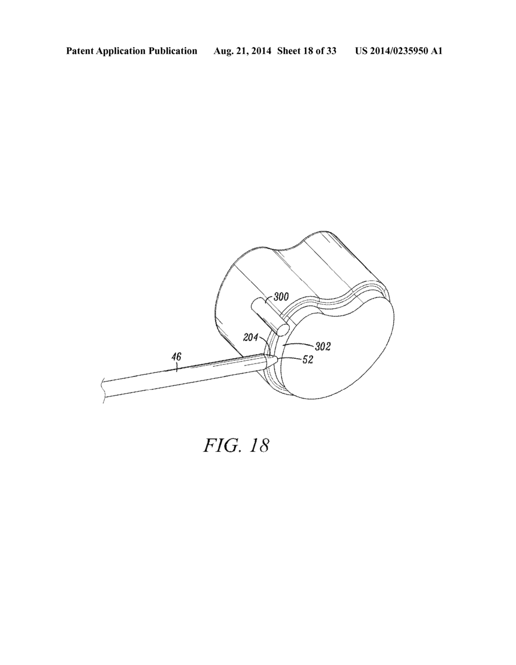 SURGICAL ACCESS SYSTEM AND RELATED METHODS - diagram, schematic, and image 19