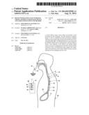 DEVICE WITH ACTIVE VALVE TO BLOCK EMESIS AND REFLUX BLOCKAGE DEVICE AND     ASSOCIATED SYSTEM AND METHOD diagram and image