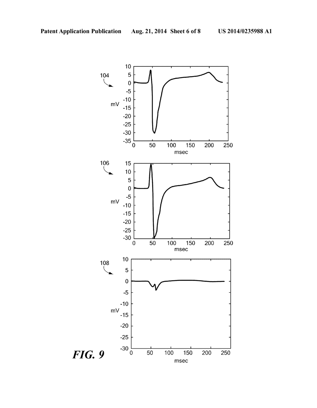 METHODS FOR SIMULTANEOUS CARDIAC SUBSTRATE MAPPING USING SPATIAL     CORRELATION MAPS BETWEEN NEIGHBORING UNIPOLAR ELECTROGRAMS - diagram, schematic, and image 07