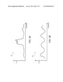 ECG Rhythym Advisory Method diagram and image