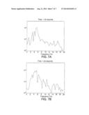 ECG Rhythym Advisory Method diagram and image