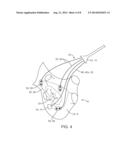 Apparatus and Method for the Detection and Treatment of Atrial     Fibrillation diagram and image