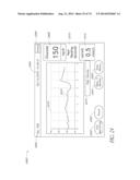 ADJUSTABLE CONNECTOR, IMPROVED FLUID FLOW AND REDUCED CLOTTING RISK diagram and image