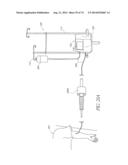 ADJUSTABLE CONNECTOR, IMPROVED FLUID FLOW AND REDUCED CLOTTING RISK diagram and image