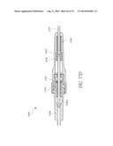 ADJUSTABLE CONNECTOR, IMPROVED FLUID FLOW AND REDUCED CLOTTING RISK diagram and image