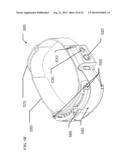 METHOD AND APPARATUS FOR THE TREATMENT OF HEADACHE diagram and image