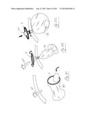 PNEUMOPERITONEUM DEVICE diagram and image