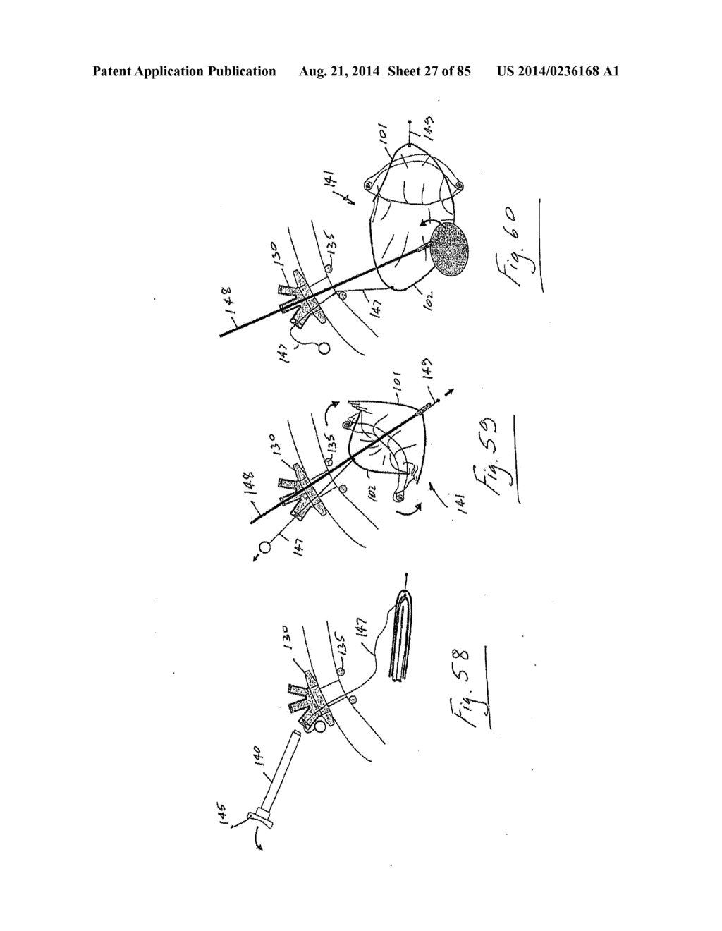 PNEUMOPERITONEUM DEVICE - diagram, schematic, and image 28