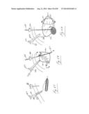 PNEUMOPERITONEUM DEVICE diagram and image