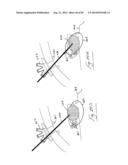 PNEUMOPERITONEUM DEVICE diagram and image