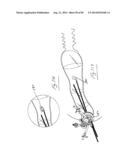 PNEUMOPERITONEUM DEVICE diagram and image