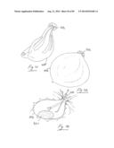 PNEUMOPERITONEUM DEVICE diagram and image