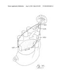 PNEUMOPERITONEUM DEVICE diagram and image