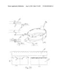 PNEUMOPERITONEUM DEVICE diagram and image