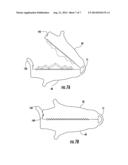 MULTI-COMPONENT DETACHABLE JAW TOOLS AND METHODS OF USING AND MAKING SAME diagram and image