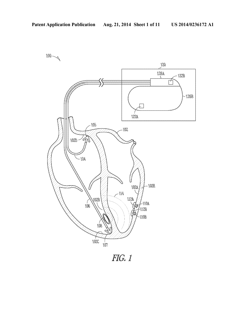 WIRELESS TISSUE ELECTROSTIMULATION - diagram, schematic, and image 02