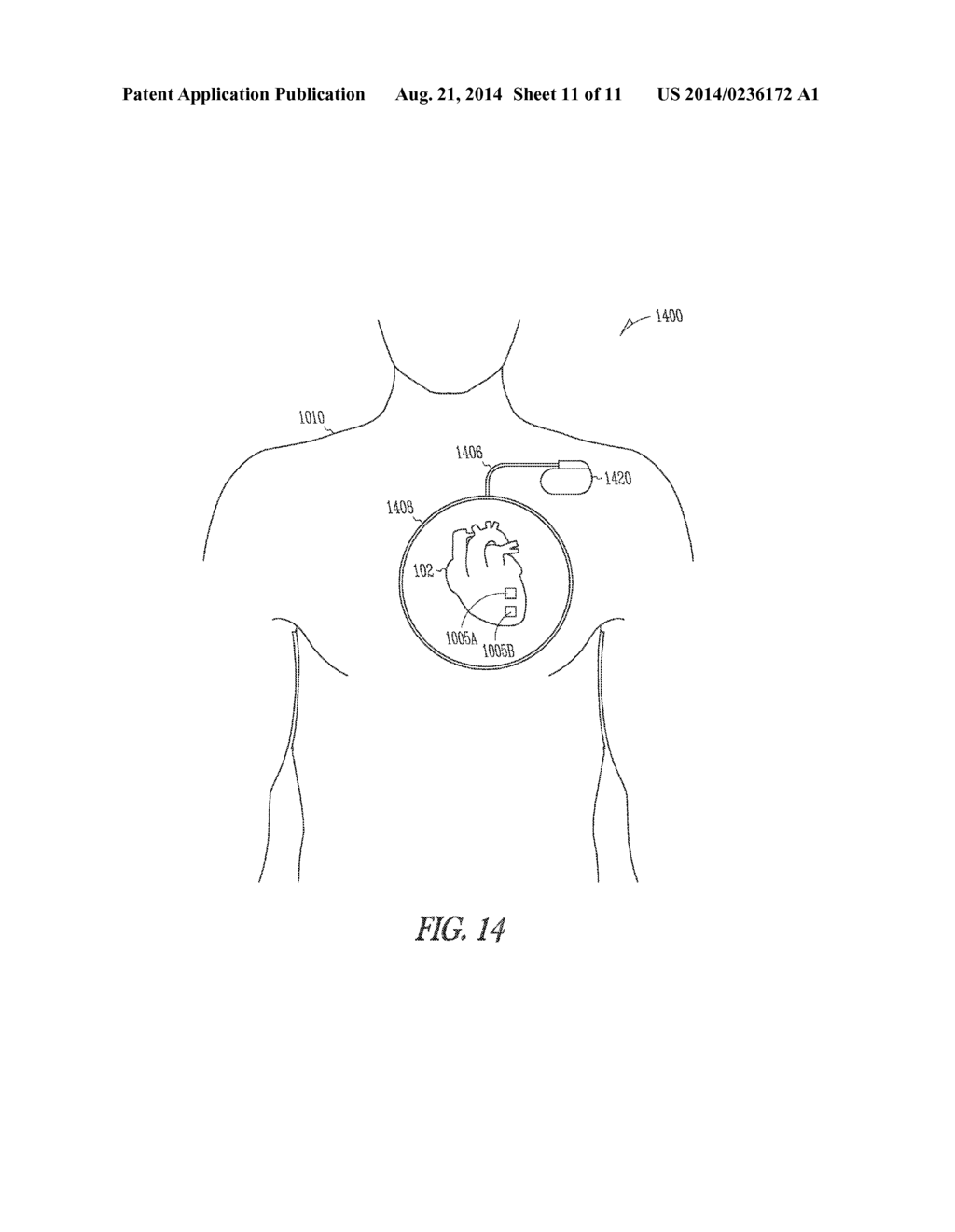 WIRELESS TISSUE ELECTROSTIMULATION - diagram, schematic, and image 12