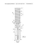 TISSUE GRAFT ANCHOR ASSEMBLY AND INSTRUMENTATION FOR USE THEREWITH diagram and image