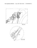 TISSUE GRAFT ANCHOR ASSEMBLY AND INSTRUMENTATION FOR USE THEREWITH diagram and image