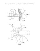 TISSUE APERTURE SECURING AND SEALING APPARATUSES AND RELATED METHODS OF     USE diagram and image