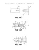 TISSUE APERTURE SECURING AND SEALING APPARATUSES AND RELATED METHODS OF     USE diagram and image