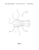 TISSUE APERTURE SECURING AND SEALING APPARATUSES AND RELATED METHODS OF     USE diagram and image