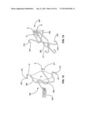 TISSUE APERTURE SECURING AND SEALING APPARATUSES AND RELATED METHODS OF     USE diagram and image