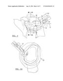 Method And Apparatus For Passing A Suture diagram and image