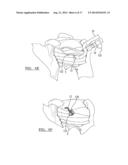 Method And Apparatus For Passing A Suture diagram and image