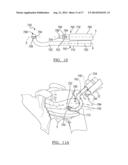 Method And Apparatus For Passing A Suture diagram and image