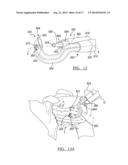 Method And Apparatus For Passing A Suture diagram and image