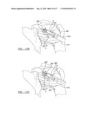 Method And Apparatus For Passing A Suture diagram and image